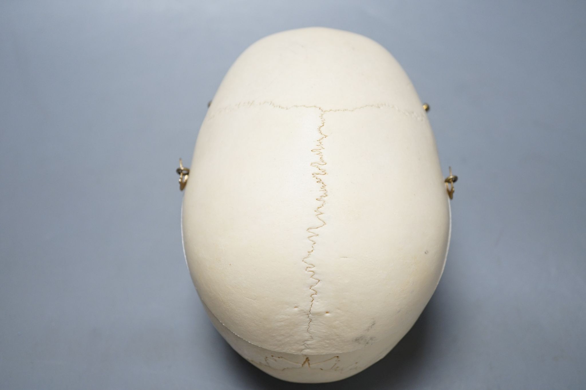 A human skull, acquired c.1976., 14 cms high x 19.5 wide.